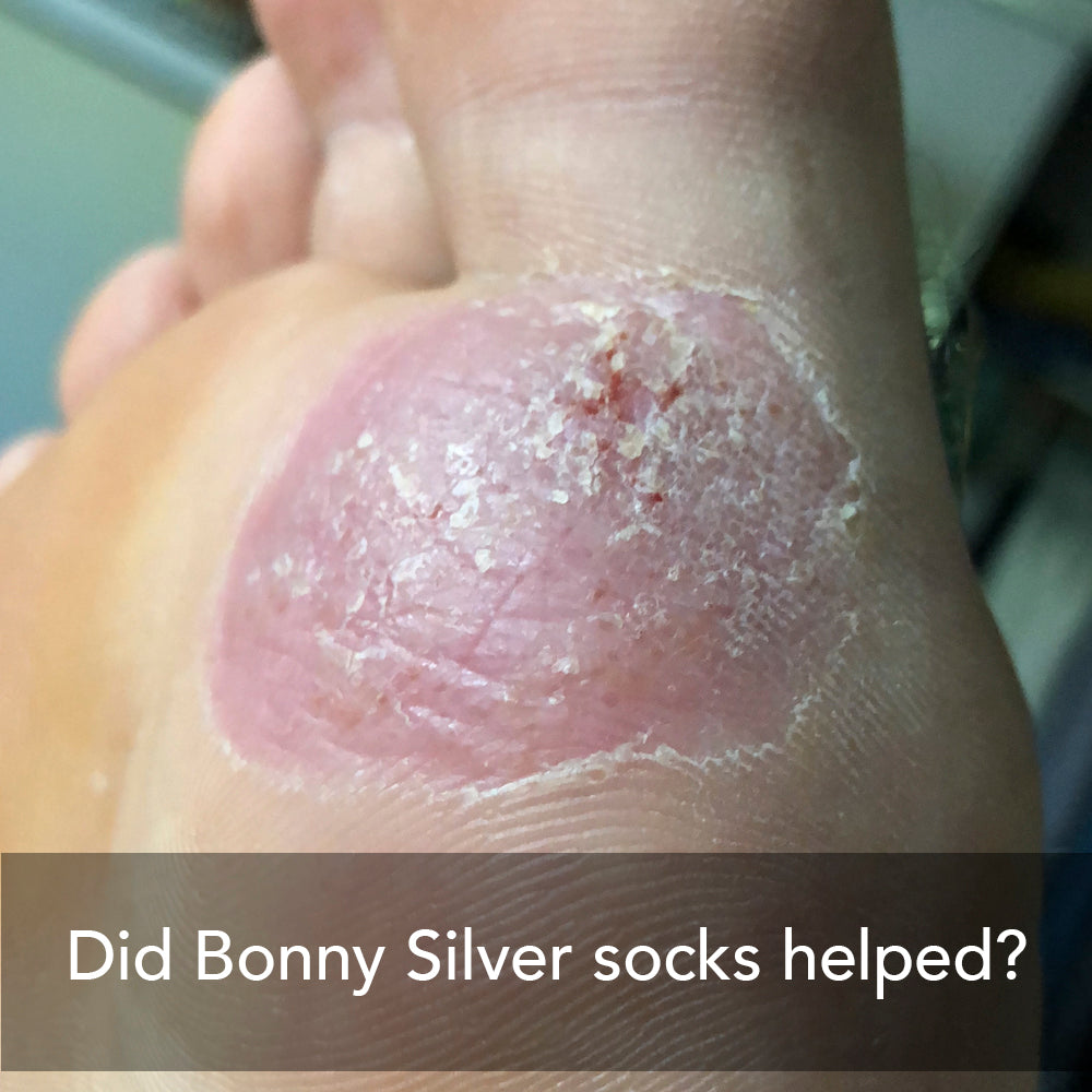 What helps foot wounds heal faster?
